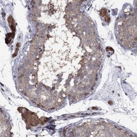 IPP Antibody in Immunohistochemistry (Paraffin) (IHC (P))