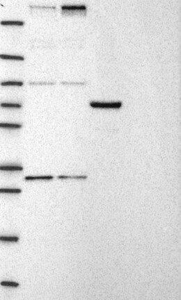 CHD8 Antibody in Western Blot (WB)