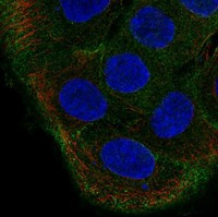TBC1D2 Antibody in Immunocytochemistry (ICC/IF)