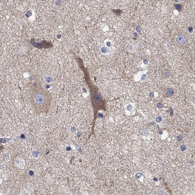 Clavesin-1 Antibody in Immunohistochemistry (Paraffin) (IHC (P))