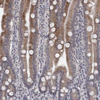 UNC5B Antibody in Immunohistochemistry (Paraffin) (IHC (P))