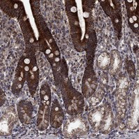 DHRS1 Antibody in Immunohistochemistry (Paraffin) (IHC (P))