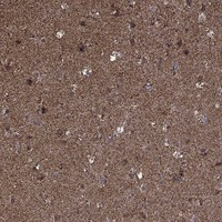 MAP1 Antibody in Immunohistochemistry (Paraffin) (IHC (P))