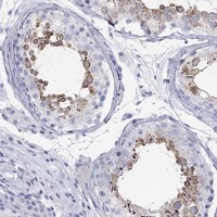 SPATA9 Antibody in Immunohistochemistry (Paraffin) (IHC (P))