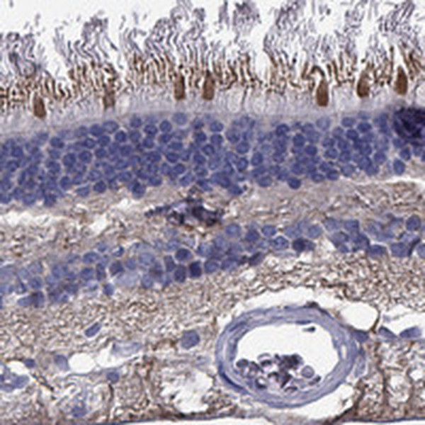 CFAP161 Antibody in Immunohistochemistry (Paraffin) (IHC (P))
