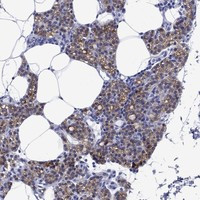 BSPRY Antibody in Immunohistochemistry (Paraffin) (IHC (P))