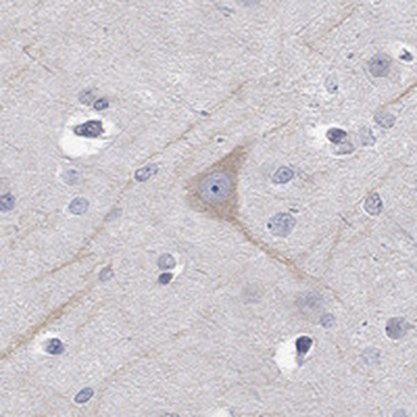 PCDH11X Antibody in Immunohistochemistry (Paraffin) (IHC (P))