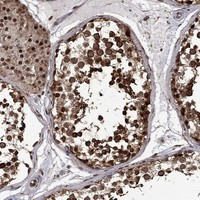 KPNA3 Antibody in Immunohistochemistry (Paraffin) (IHC (P))