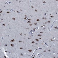 PNMAL1 Antibody in Immunohistochemistry (Paraffin) (IHC (P))