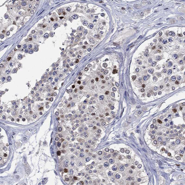 ZNHIT3 Antibody in Immunohistochemistry (Paraffin) (IHC (P))