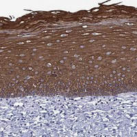 TMPRSS11A Antibody in Immunohistochemistry (Paraffin) (IHC (P))
