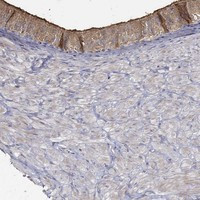 EMILIN3 Antibody in Immunohistochemistry (Paraffin) (IHC (P))