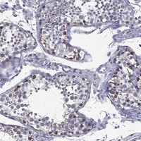 C19orf18 Antibody in Immunohistochemistry (Paraffin) (IHC (P))