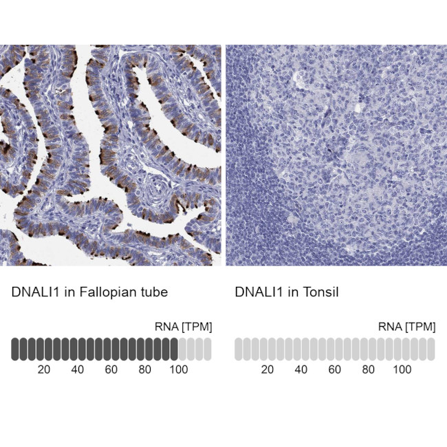 DNALI1 Antibody in Immunohistochemistry (Paraffin) (IHC (P))