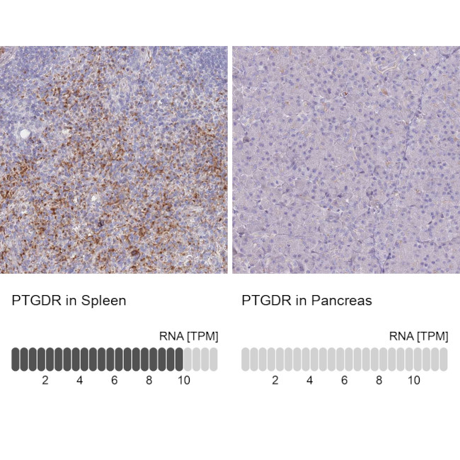 PTGDR Antibody in Immunohistochemistry (Paraffin) (IHC (P))