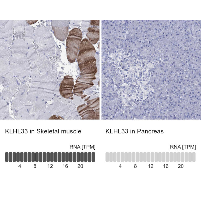 KLHL33 Antibody in Immunohistochemistry (Paraffin) (IHC (P))