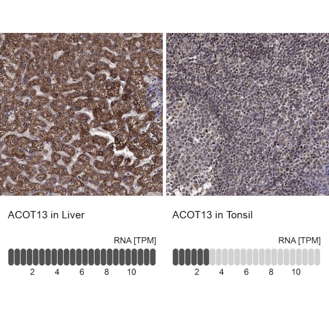 THEM2 Antibody in Immunohistochemistry (Paraffin) (IHC (P))