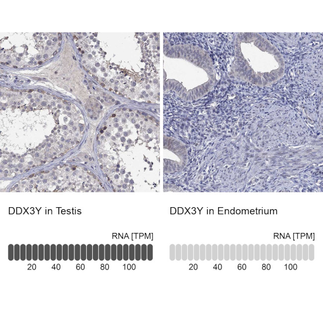 DDX3Y Antibody in Immunohistochemistry (Paraffin) (IHC (P))