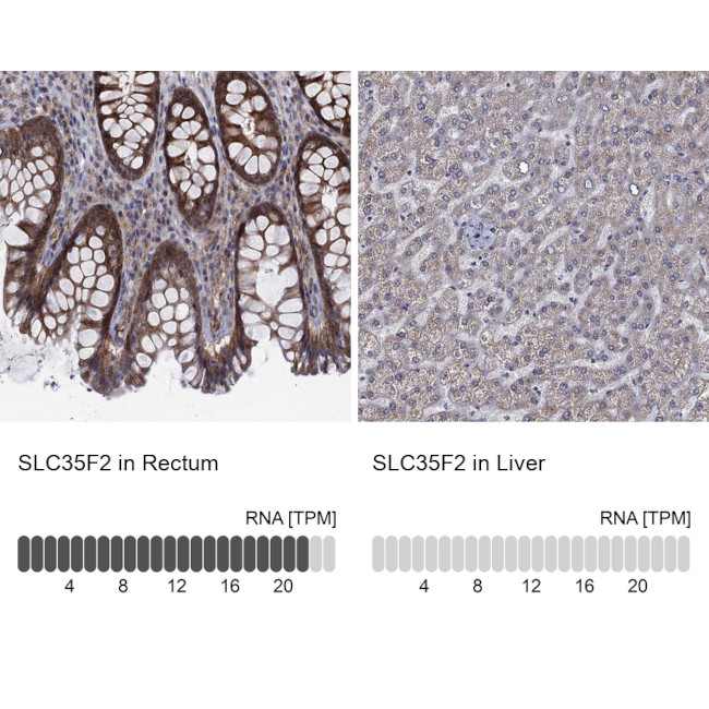 SLC35F2 Antibody in Immunohistochemistry (Paraffin) (IHC (P))
