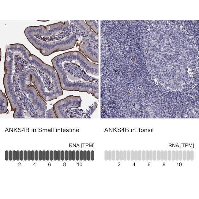 ANKS4B Antibody in Immunohistochemistry (Paraffin) (IHC (P))