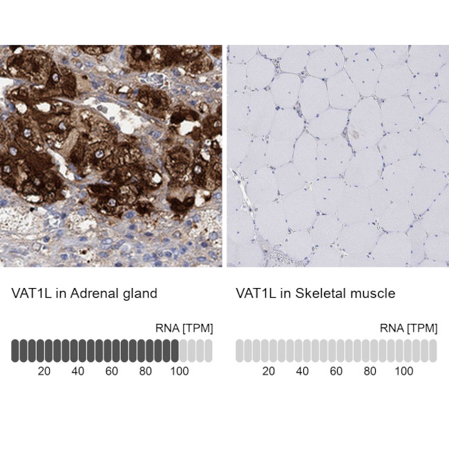VAT1L Antibody in Immunohistochemistry (Paraffin) (IHC (P))