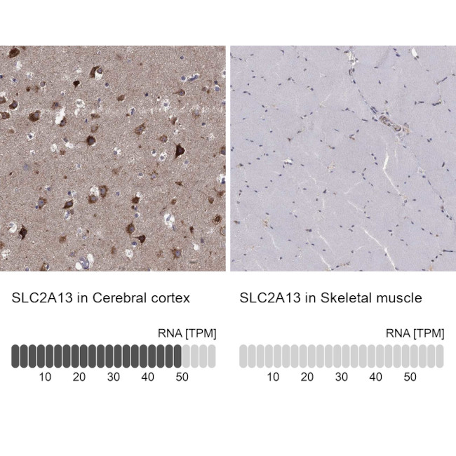 SLC2A13 Antibody in Immunohistochemistry (Paraffin) (IHC (P))