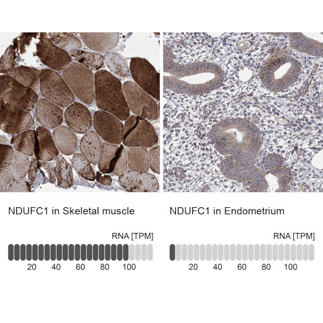 NDUFC1 Antibody in Immunohistochemistry (Paraffin) (IHC (P))