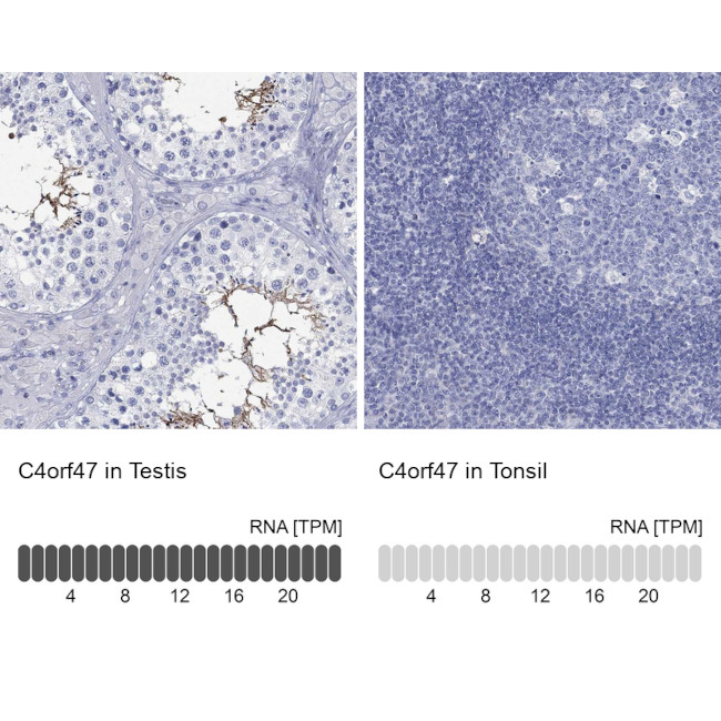 C4orf47 Antibody in Immunohistochemistry (Paraffin) (IHC (P))
