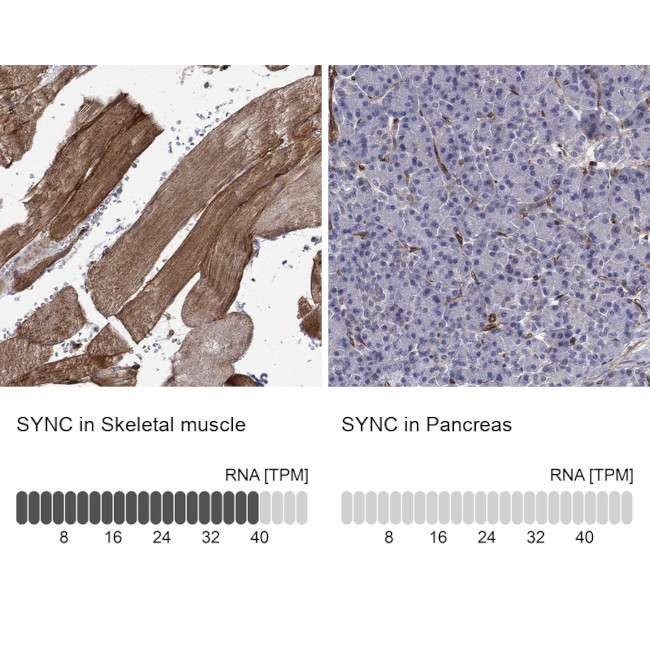SYNC Antibody in Immunohistochemistry (Paraffin) (IHC (P))