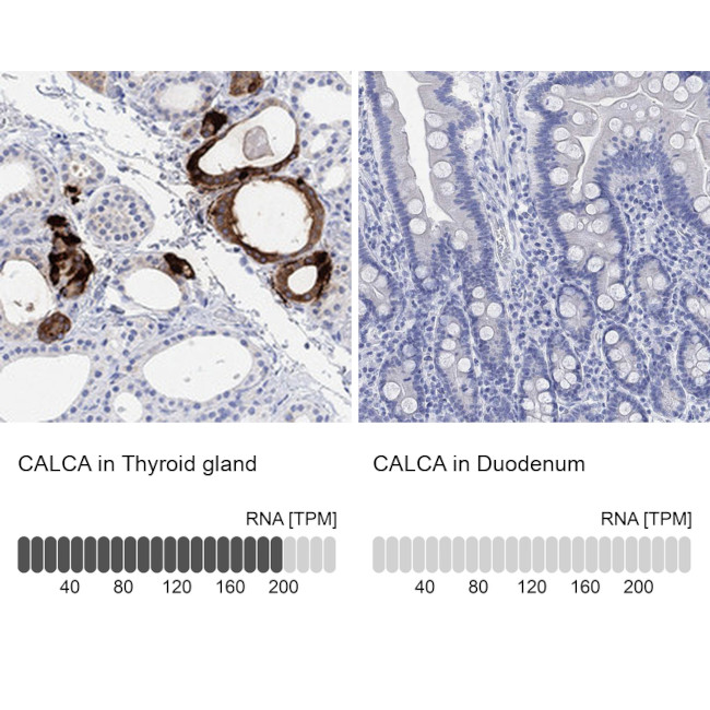 Calcitonin Antibody in Immunohistochemistry (Paraffin) (IHC (P))