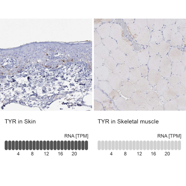 Tyrosinase Antibody in Immunohistochemistry (Paraffin) (IHC (P))
