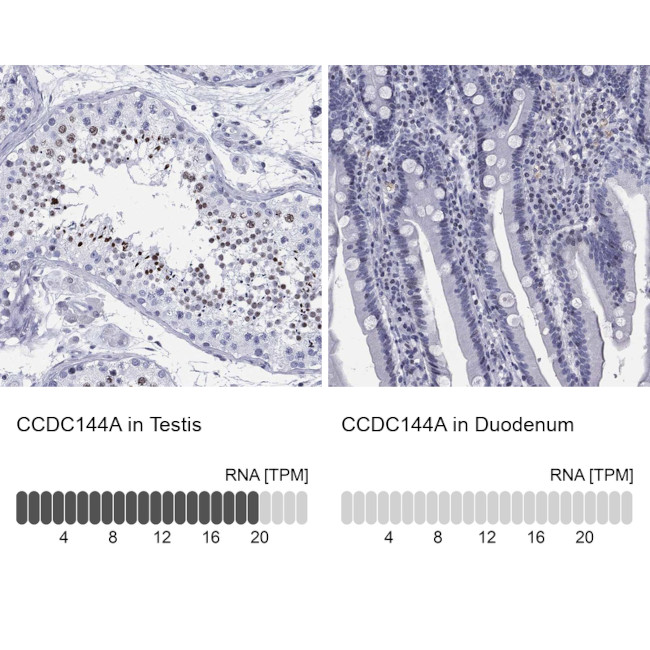 CCDC144A Antibody in Immunohistochemistry (Paraffin) (IHC (P))