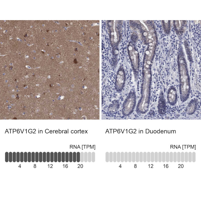 ATP6V1G2 Antibody in Immunohistochemistry (Paraffin) (IHC (P))