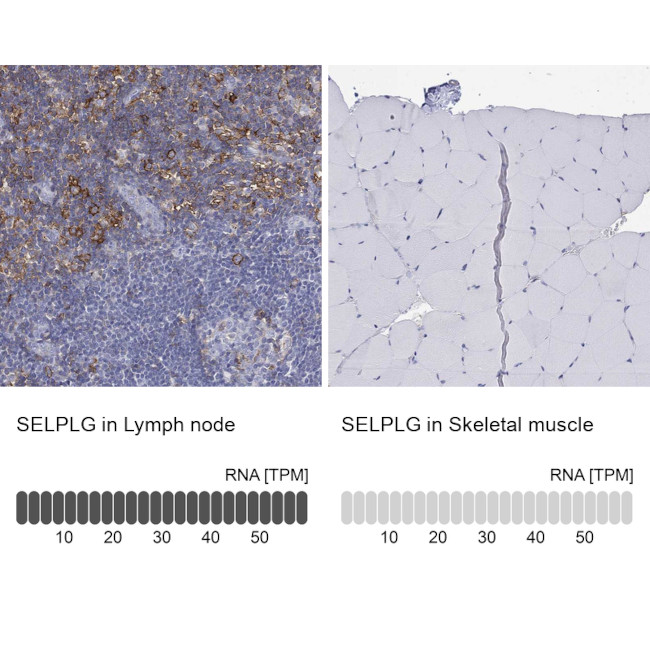 CD162 (PSGL-1) Antibody in Immunohistochemistry (Paraffin) (IHC (P))