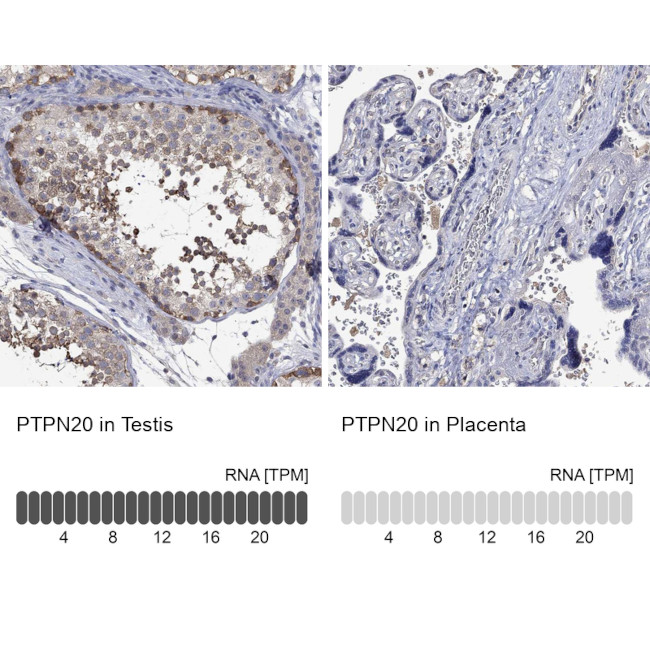 PTPN20A Antibody in Immunohistochemistry (Paraffin) (IHC (P))