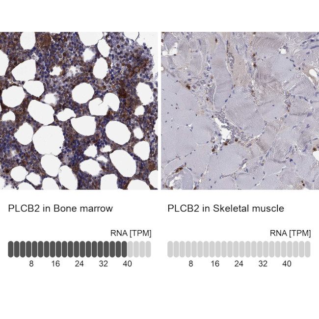 PLCB2 Antibody in Immunohistochemistry (Paraffin) (IHC (P))