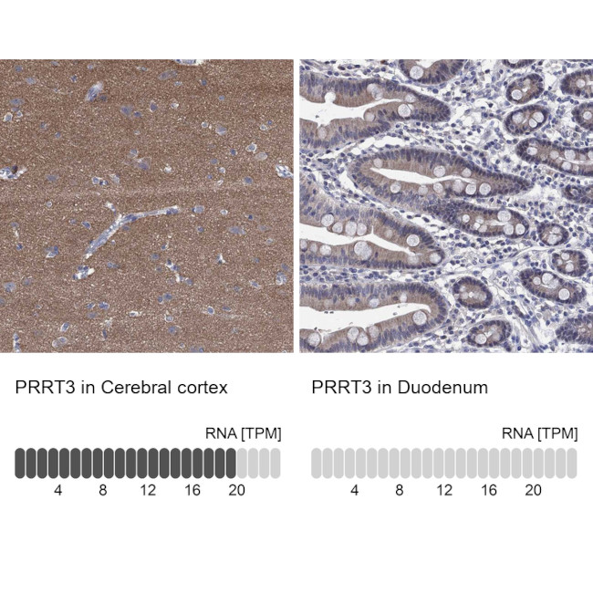 PRRT3 Antibody in Immunohistochemistry (Paraffin) (IHC (P))