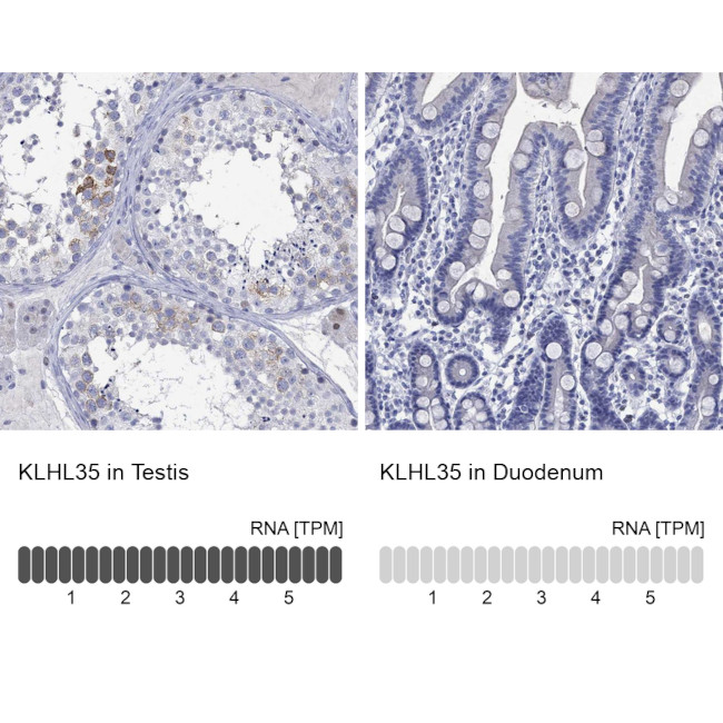 KLHL35 Antibody in Immunohistochemistry (Paraffin) (IHC (P))