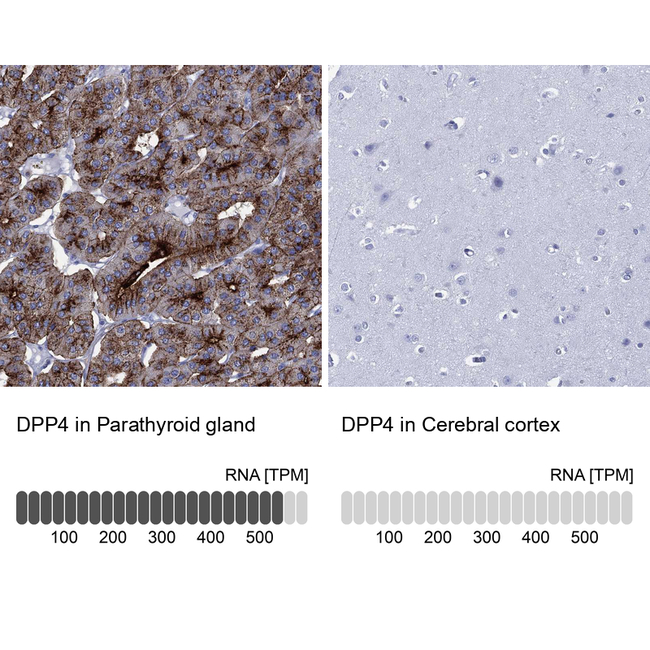 DPP4 Antibody in Immunohistochemistry (Paraffin) (IHC (P))