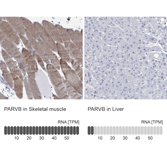 PARVB Antibody in Immunohistochemistry (Paraffin) (IHC (P))