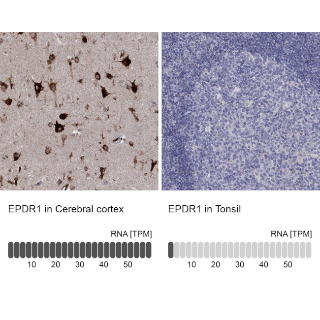 EPDR1 Antibody in Immunohistochemistry (Paraffin) (IHC (P))