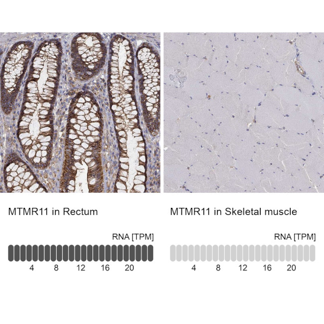 MTMR11 Antibody in Immunohistochemistry (Paraffin) (IHC (P))