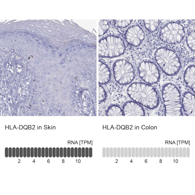 HLA-DQB2 Antibody in Immunohistochemistry (Paraffin) (IHC (P))