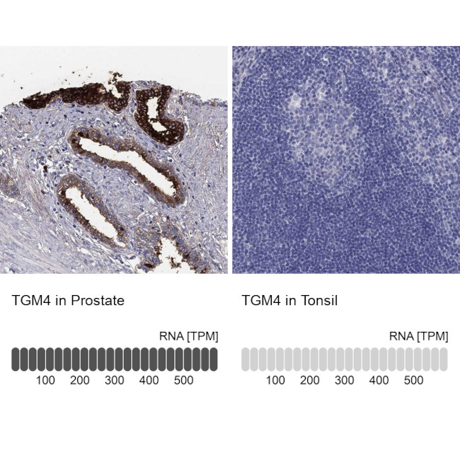TGM4 Antibody in Immunohistochemistry (Paraffin) (IHC (P))