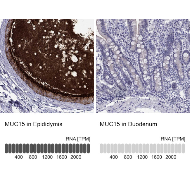 MUC15 Antibody in Immunohistochemistry (Paraffin) (IHC (P))