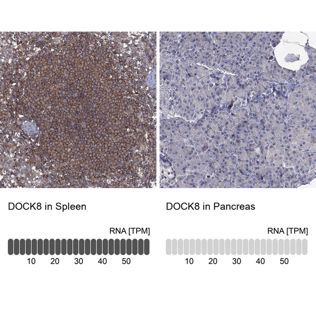 DOCK8 Antibody in Immunohistochemistry (Paraffin) (IHC (P))