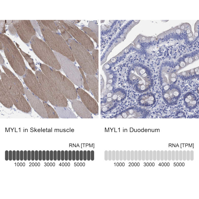 MYL1 Antibody in Immunohistochemistry (Paraffin) (IHC (P))