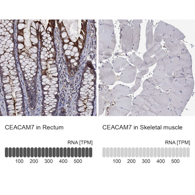 CEACAM7 Antibody in Immunohistochemistry (Paraffin) (IHC (P))