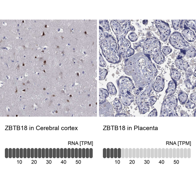 ZNF238 Antibody in Immunohistochemistry (Paraffin) (IHC (P))