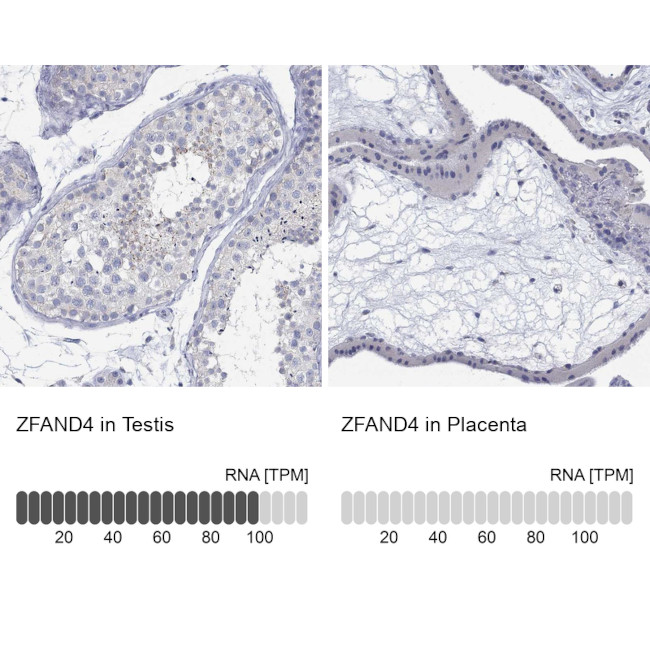 ZFAND4 Antibody in Immunohistochemistry (Paraffin) (IHC (P))